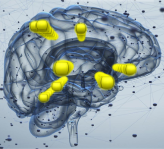 NeuroTracker
